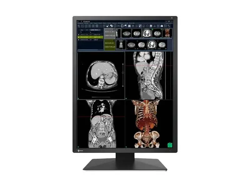 Медицински монитор EIZO Radi Force RX270 - 21.3" инч, 2MP Цветен LED